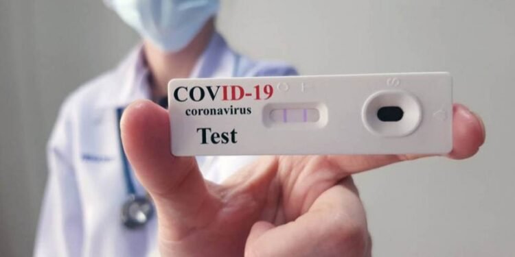 El resultado de los autotest de coronavirus se deberá notificar a las farmacias