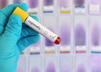 Legionella: las claves para comprender el brote en Tucumán