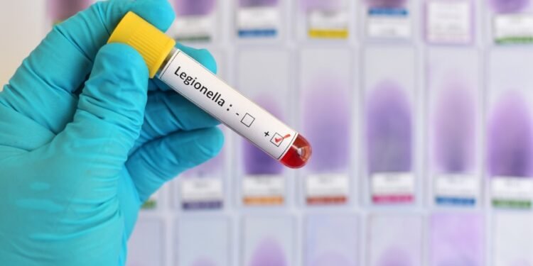 Legionella: las claves para comprender el brote en Tucumán