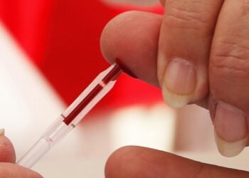 Más de 140 mil personas viven con VIH Sida en la Argentina y no descendió la mortalidad