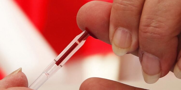 Más de 140 mil personas viven con VIH Sida en la Argentina y no descendió la mortalidad