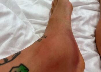 El impactante posteo del Papu Gómez: “Di todo por ganar la Copa del Mundo y hoy mi tobillo lo está pagando”