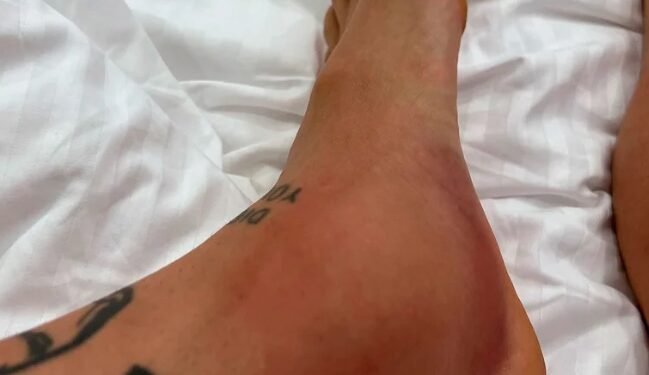 El impactante posteo del Papu Gómez: “Di todo por ganar la Copa del Mundo y hoy mi tobillo lo está pagando”