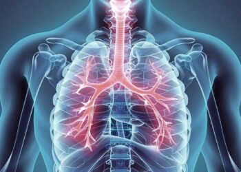 Afirman que 7 de cada 10 personas que tienen EPOC no están diagnosticadas