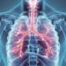 Afirman que 7 de cada 10 personas que tienen EPOC no están diagnosticadas