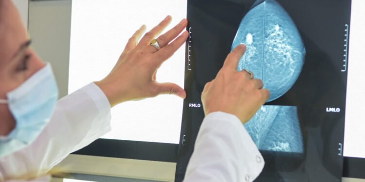 Salud recuerda las señales de alerta y controles de prevención del cáncer de mama
