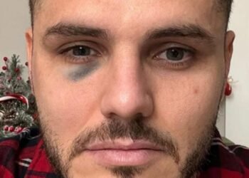Icardi terminó con un ojo morado y Galatasaray denunció manipulación del VAR