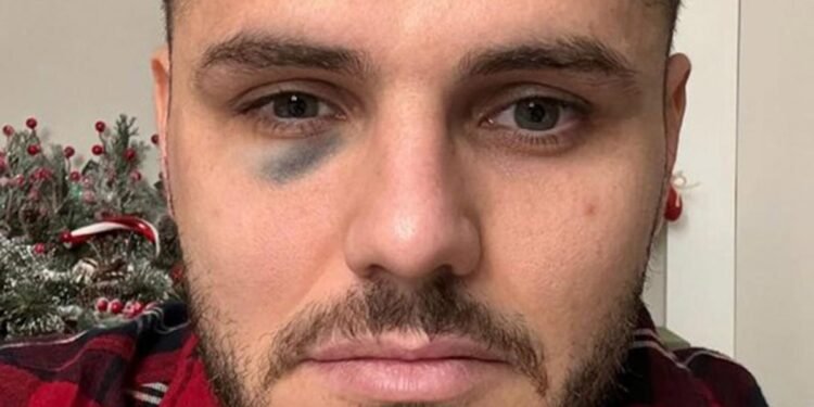 Icardi terminó con un ojo morado y Galatasaray denunció manipulación del VAR