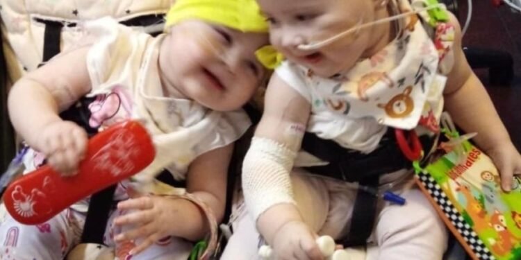 Lamentamos la pérdida de Jana, la gemela que luchó incansablemente contra la leucemia