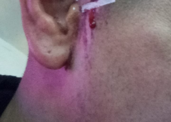 Violenta agresión en la Liga Santafesina: un jugador hirió con un cuchillo a otro