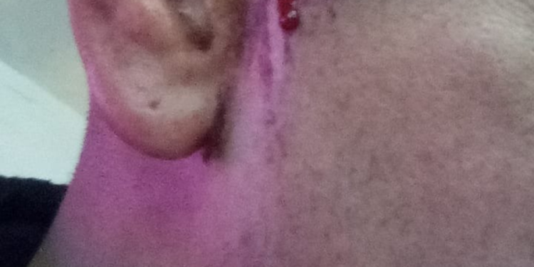 Violenta agresión en la Liga Santafesina: un jugador hirió con un cuchillo a otro