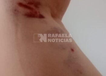 Temor en barrio Sarmiento: una vecina fue atacada por perros sueltos