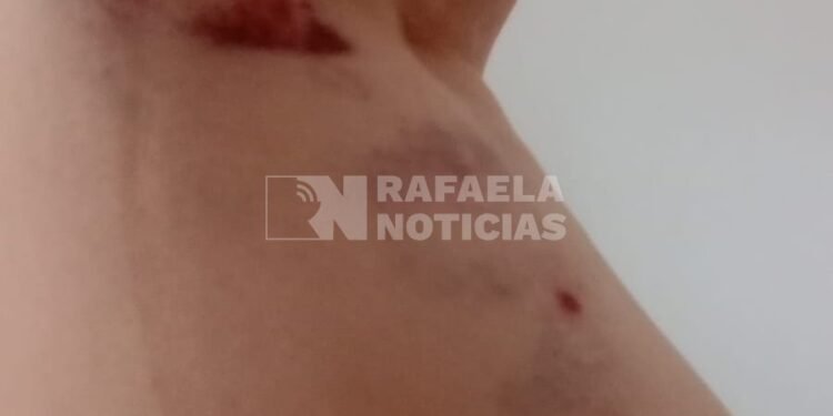 Temor en barrio Sarmiento: una vecina fue atacada por perros sueltos