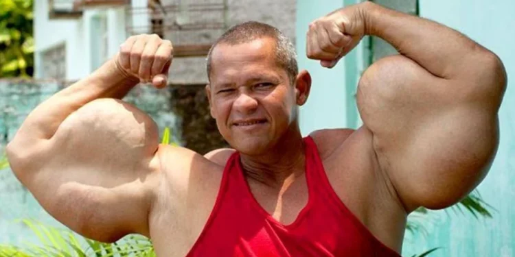 Prácticas de riesgo Murió “Popeye brasileño”: el fisicoculturista que se inyectaba aceite para aumentar sus bíceps