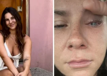 La historia de Vivian Nosovitsky Dolor, oscuridad y miedo a quedar ciega: el calvario de una tiktoker a la que un parásito le devoró la córnea