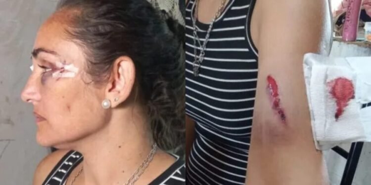 Nuevo ataque a la hermana del intendente de San José del Rincón